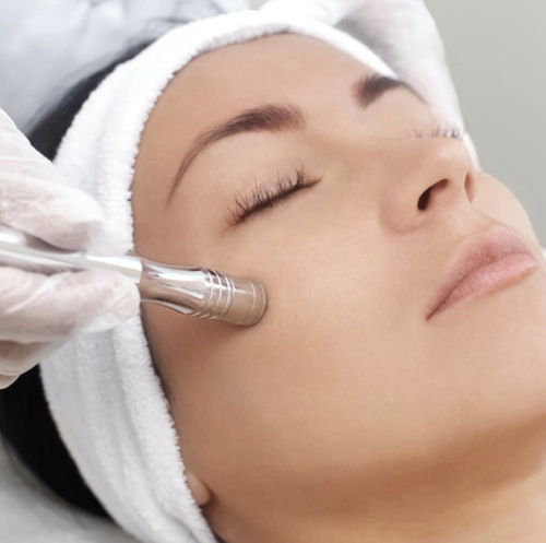 Microdermabrasion Facial